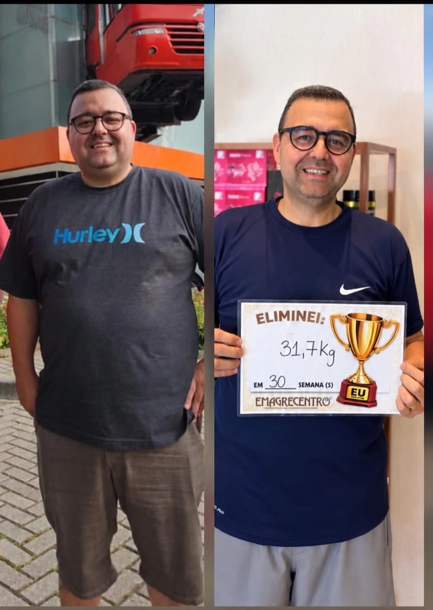 Resultado real de emagrecimento masculino, antes e depois com perda de 31,7 quilos
